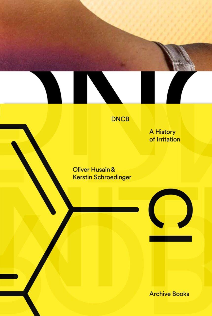 DNCB – A History of Irritation